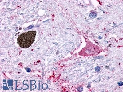 PathPlus™ Polyclonal Rabbit anti-Human ADGRF5 / GPR116 Antibody (Cytoplasmic Domain, IHC)