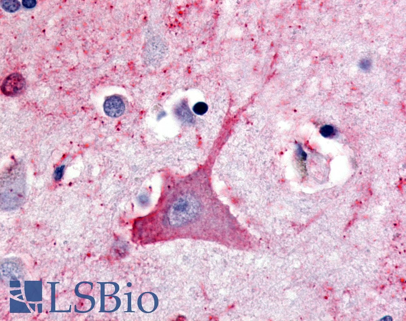IHC-plus™ Polyclonal Rabbit anti-Human TRH Receptor / TRHR Antibody (C-Terminus, IHC)