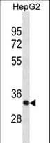 SFXN1 Antibody (aa293-321)