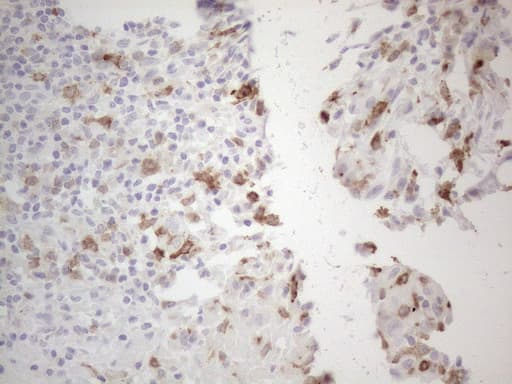 ALOX12 / 12 Lipoxygenase Antibody (clone OTI1B2)