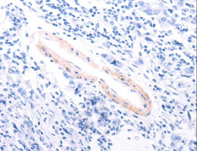 TPM1 / Tropomyosin Antibody