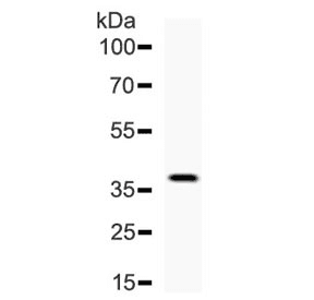 Polyclonal Rabbit anti-Human DKK1 Antibody (WB)