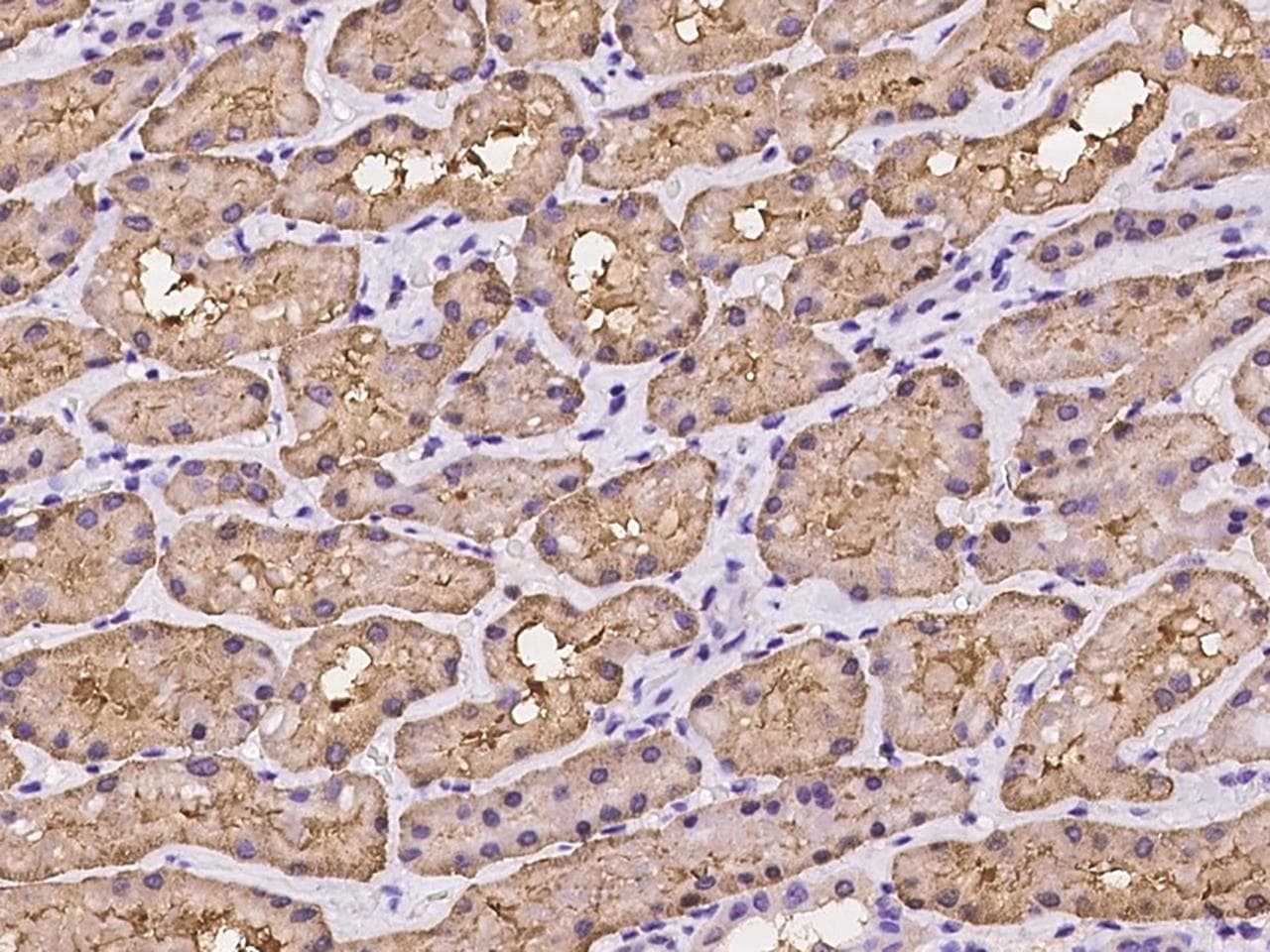 FBP1 Antibody