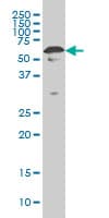IHC-plus™ YY1 Antibody (clone 4A5)