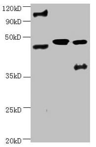 ENO2 / NSE Antibody (clone 4B1F5)