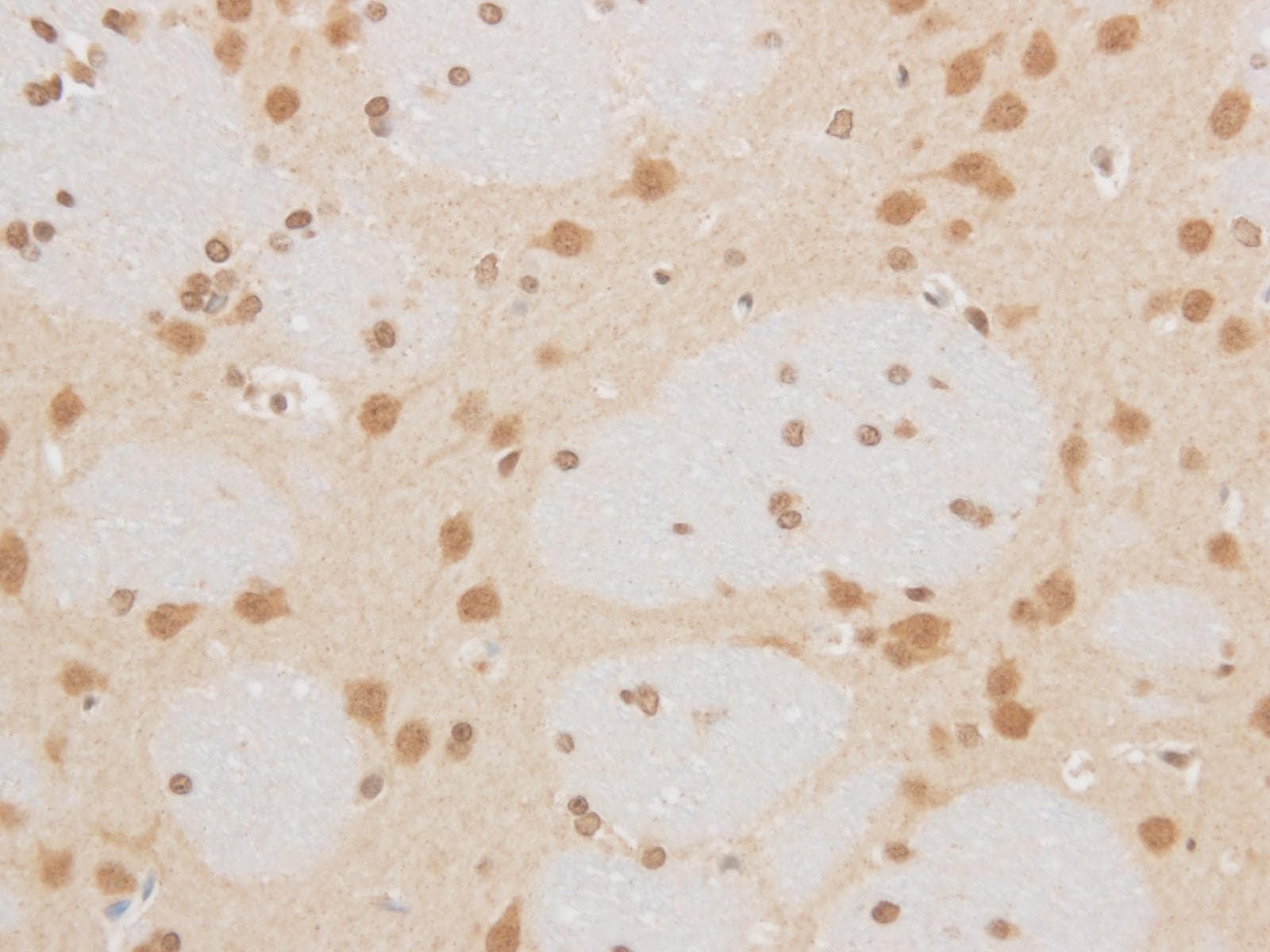 MAP2K6 / MEK6 / MKK6 Antibody