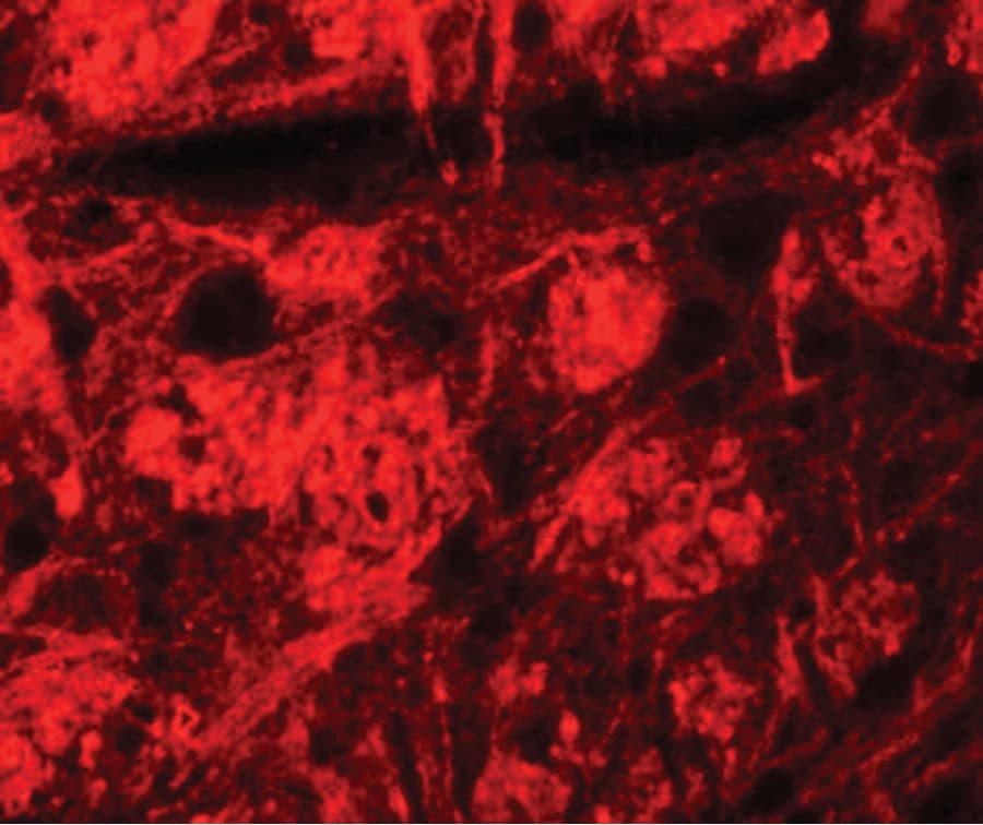 IHC-plus™ Polyclonal Rabbit anti-Human ROCK2 Antibody (IHC, IF, WB)