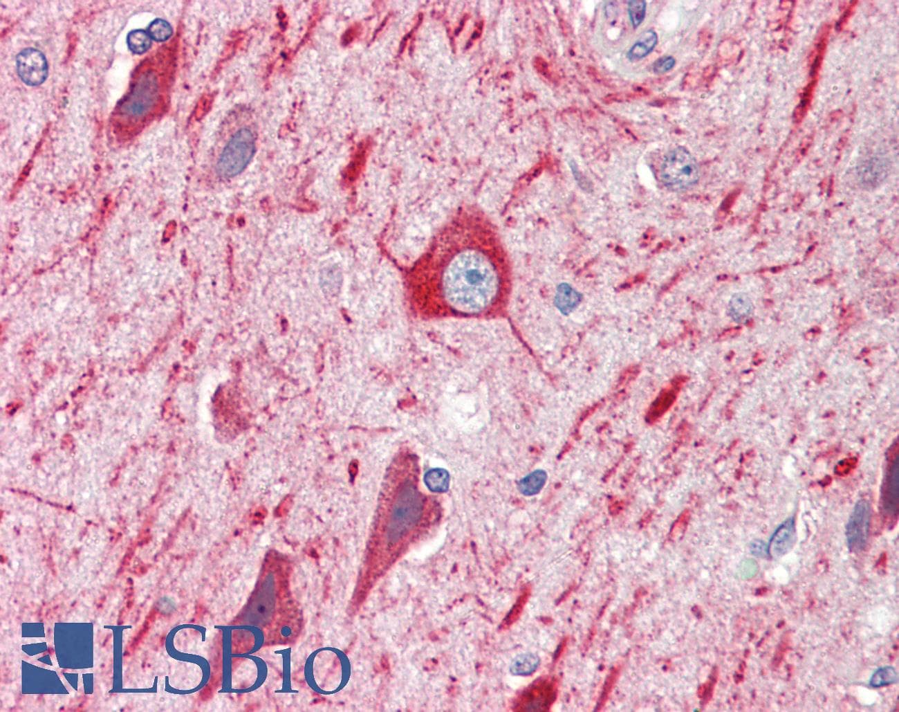 IHC-plus™ Polyclonal Goat anti-Human PRDM11 Antibody (aa465-477, IHC, WB)