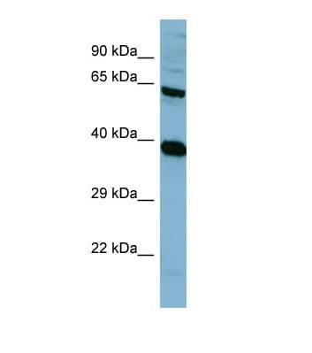PPP2R1A Antibody (N-Terminus)