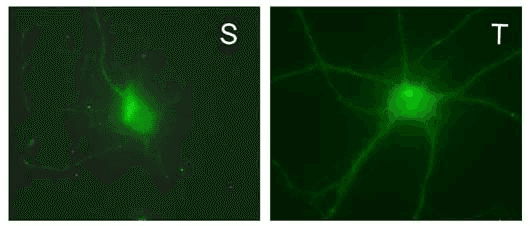 Monoclonal Mouse anti-Mouse GABRD Antibody (clone S151-3, aa15-34, IHC, IF, WB)
