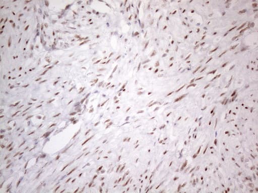 TP53BP1 / 53BP1 Antibody (aa1-300, clone OTI5E1, Carrier-free)