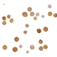 IHC-plus™ Polyclonal Rabbit anti-Human C2orf40 / ECRG4 Antibody (IHC, WB)