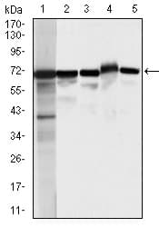 PathPlus™ Monoclonal Mouse anti-Human MSN / Moesin Antibody (clone 2C12, aa292-491, IHC, WB)