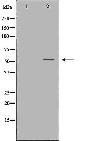 Polyclonal Rabbit anti-Human OLFM1 Antibody (IHC, WB)