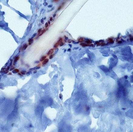 PIEZO2 / FAM38B Antibody