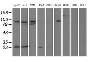 ANAPC2 / APC2 Antibody (clone OTI1B12)