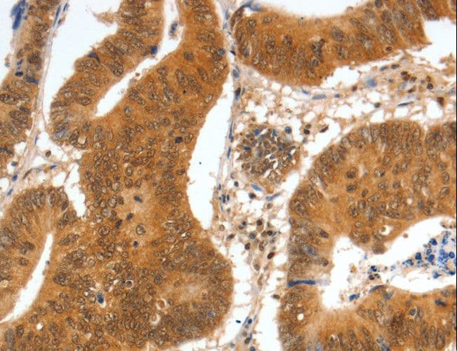 PDEF / SPDEF Antibody