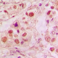 TP53 / p53 Antibody (C-Terminus)