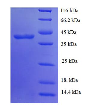 Human GLT8D2 Protein (Recombinant His)