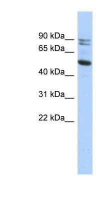Polyclonal Rabbit anti-Human CAPN10 / Calpain 10 Antibody (N-Terminus, WB)