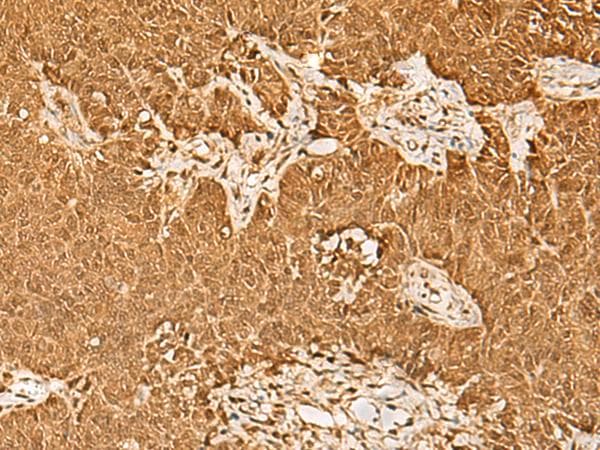 Polyclonal Rabbit anti-Human PSMA3 Antibody (IHC, WB)