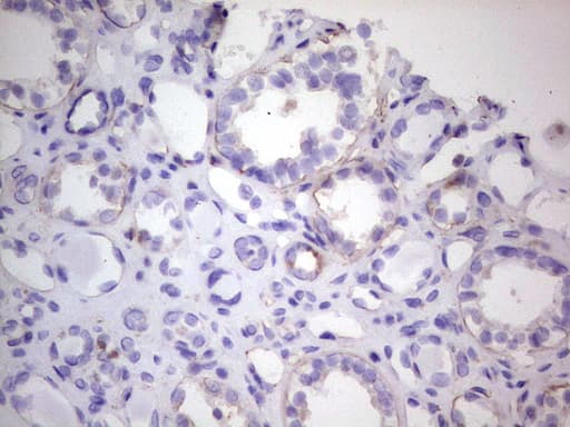 Monoclonal Mouse anti-Human CDKL2 Antibody (clone OTI12C2, aa291-493, IHC, WB)