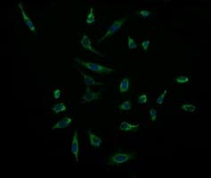 ACAA2 Antibody (clone OTI2H2)