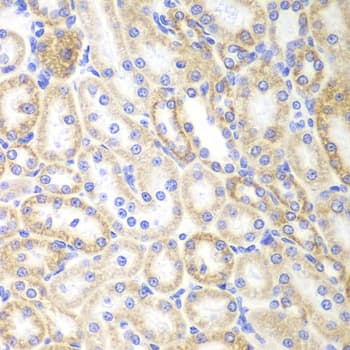 SIRT3 / Sirtuin 3 Antibody