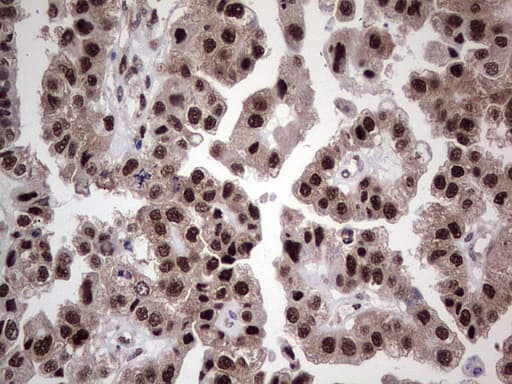 Monoclonal Mouse anti-Human RAD23B / HR23B Antibody (clone OTI7G10, aa1-253, IHC, WB)
