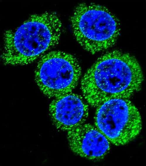 Leptin Antibody (aa8-37)