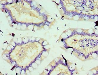 Polyclonal Rabbit anti-Human SOD3 Antibody (aa19-160, IHC)