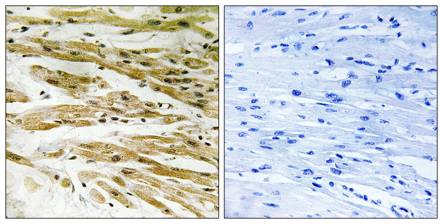DMC1 Antibody (aa61-110)