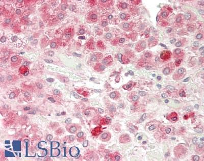 IHC-plus™ Polyclonal Rabbit anti-Human CD118 / LIF Receptor Alpha Antibody (aa1021-1055, IHC, WB)