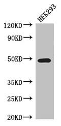 Polyclonal Rabbit anti-Human TCN2 Antibody