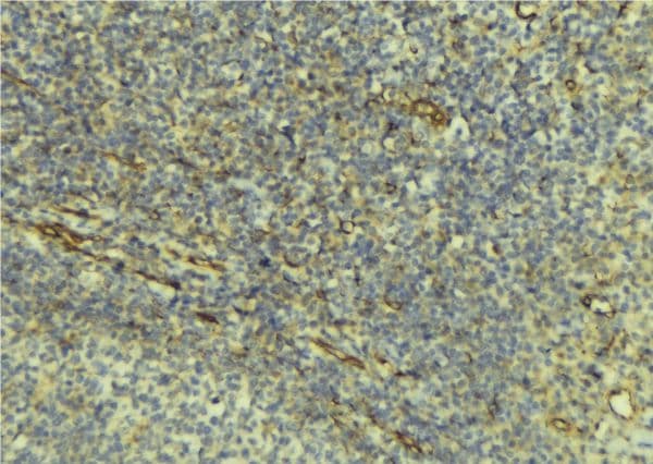 Polyclonal Rabbit anti-Human TRAIL-R3 / DCR1 Antibody (IHC, WB)