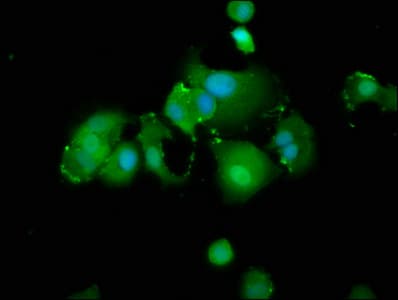 Polyclonal Rabbit anti-Human TXNIP Antibody (IF)