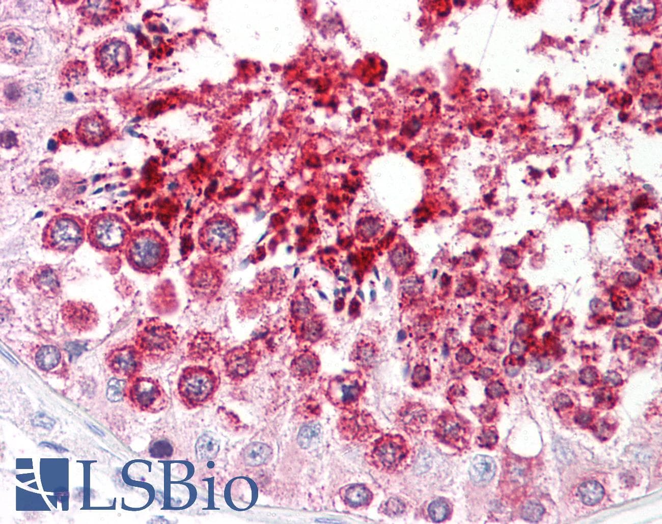 PathPlus™ Polyclonal Rabbit anti-Human HDAC6 Antibody (aa1166-1215, IHC, WB)