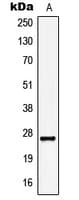 IHC-plus™ Polyclonal Rabbit anti-Human KCNMB2 Antibody (Internal, IHC, WB)