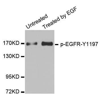 EGFR Antibody (phospho-Tyr1197)