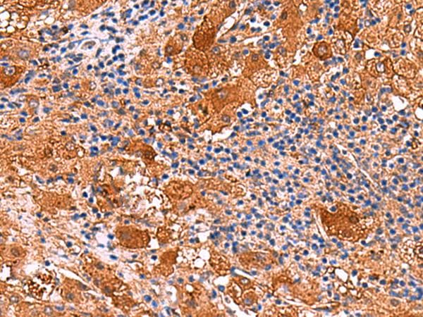 Polyclonal Rabbit anti-Human KANK3 Antibody (IHC)