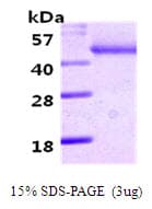 Human SERPINA12 / Vaspin Protein (Recombinant His)