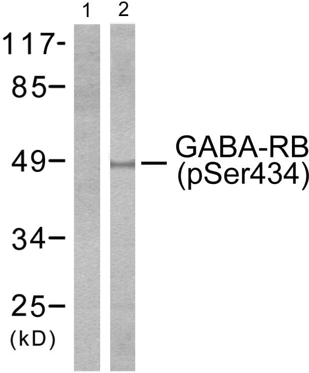 GABRB1 Antibody (phospho-Ser434)