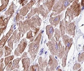 TRIM3 Antibody