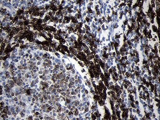 CD79B / CD79 Beta Antibody (clone OTI8A12)