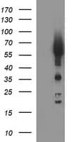 TH / Tyrosine Hydroxylase Antibody (clone OTI1A10, Carrier-free)