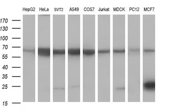CD22 Antibody (clone OTI1F12)