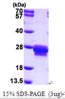Human TAGLN / Transgelin / SM22 Protein (Recombinant His)