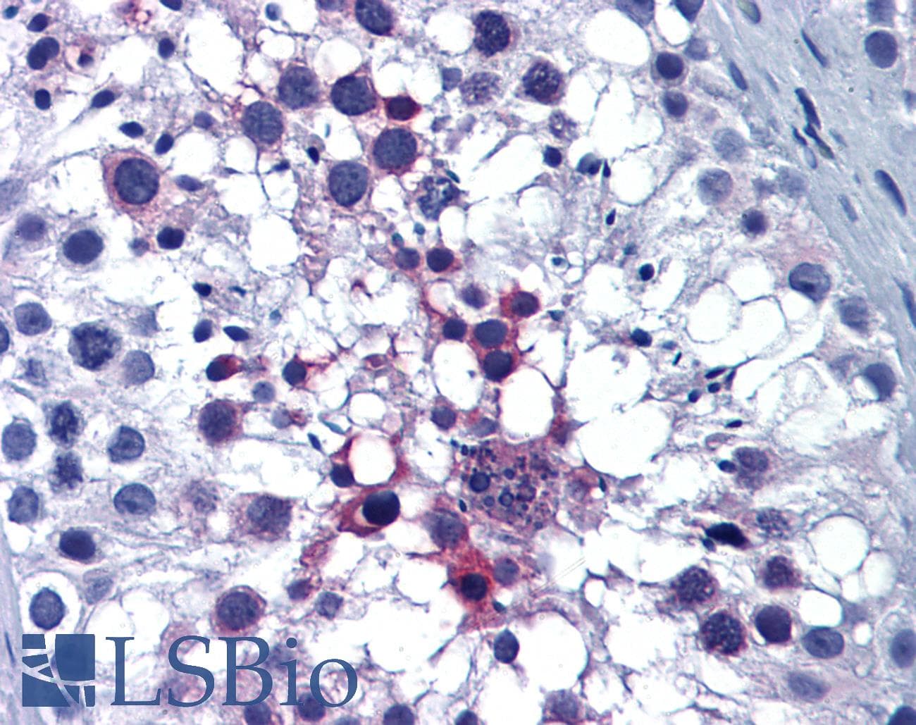 IHC-plus™ ERP44 Antibody (clone 3C7)