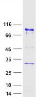 Human UTP3 / CRLZ1 Protein (Recombinant Myc-DDK (Flag))
