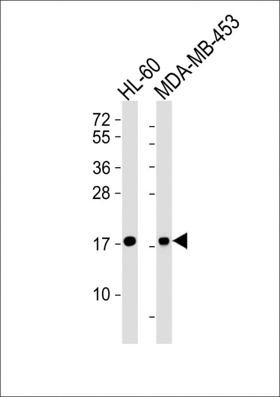 FHIT Antibody (clone 1093CT23.1.2)